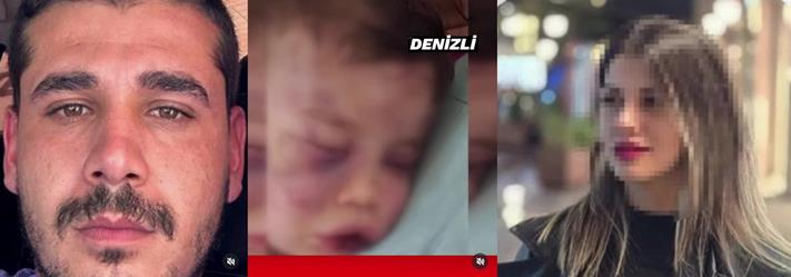 Denizli'de 2 Yaşındaki Çocuğa Şiddet Uygulayan Zanlıdan Kan Donduran Savunma!