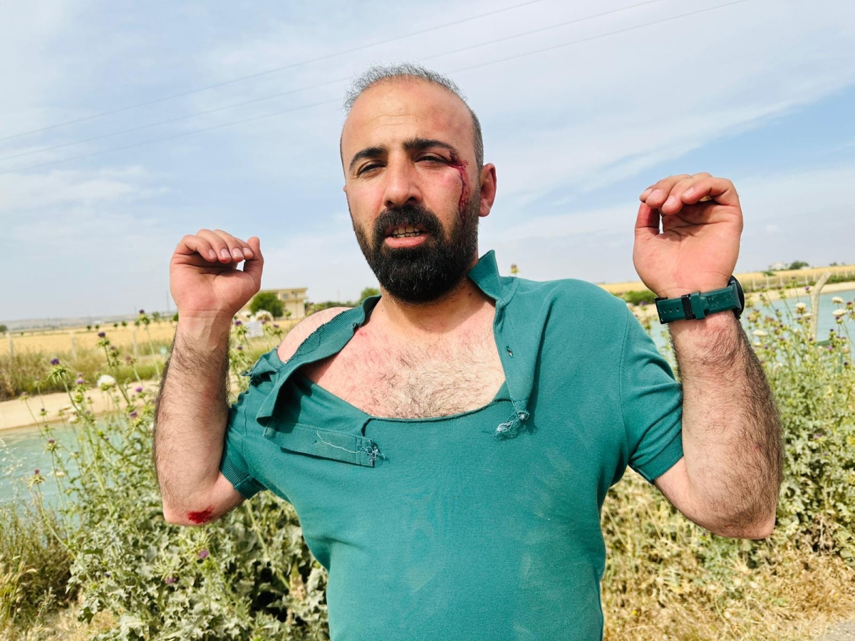 HDP Şanlıurfa İl Eş Başkanı Avukat Ahmet Atış,