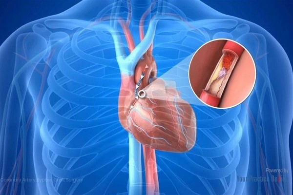 Prof. Dr. Nevrez Koylan: Koroner bypass veya stent sonrası &Prime;motoru sıfırladık&Prime; zannetmeyin