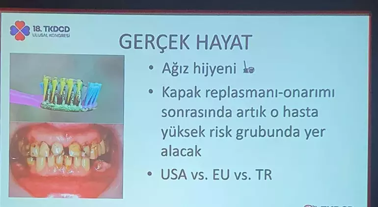 Tedavi ettiği vakalardan çarpıcı fotoğraf paylaştı! 6 kişilik aile aynı diş fırçasını kullandı
