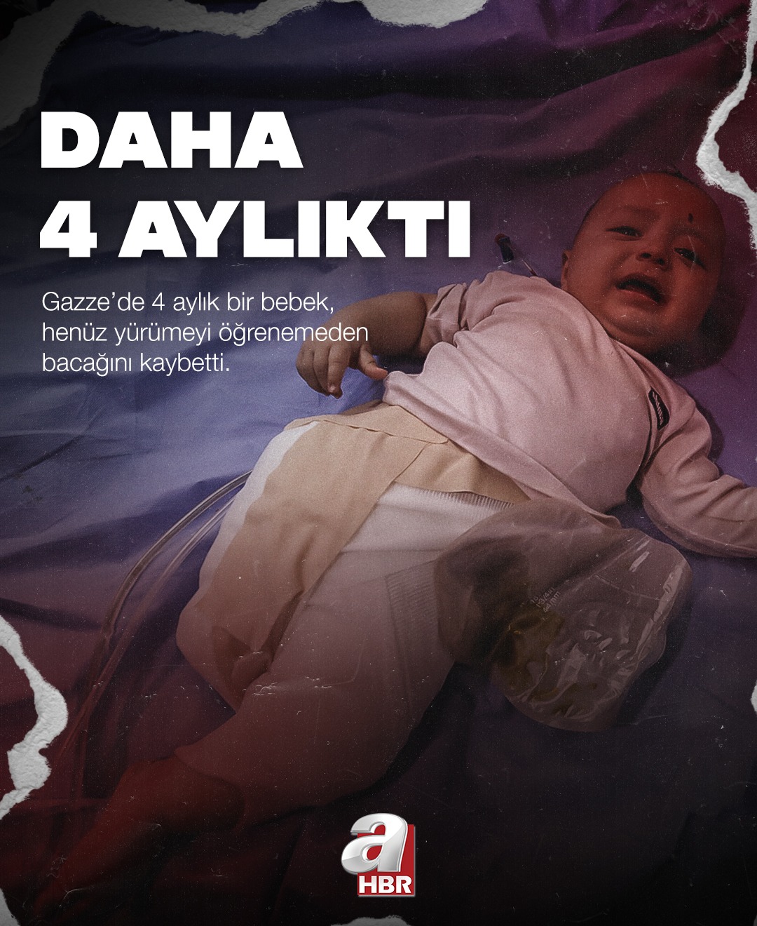 DAHA 4 AYLIKTI… İsrail Saldırısında Bebeğin Bacağı Koptu