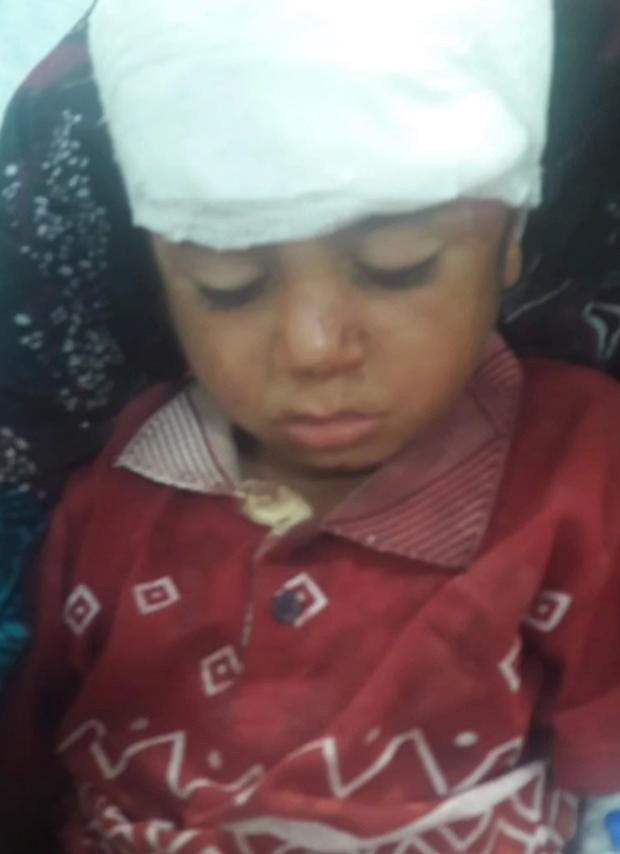 Şanlıurfa'da atın teptiği çocuk yaralandı
