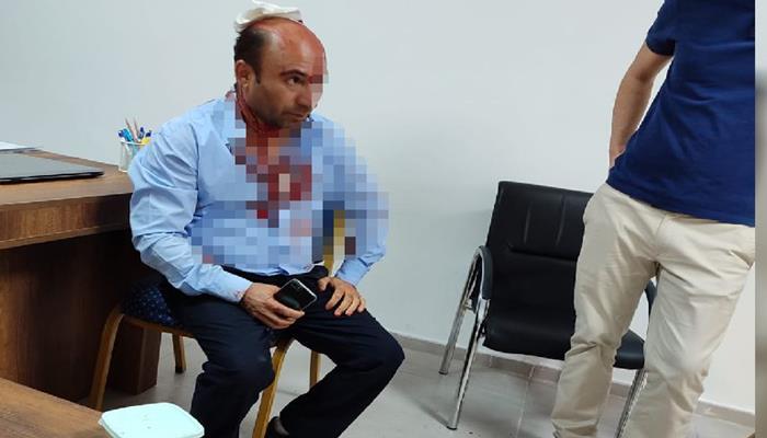 Şanlıurfa'da okul müdürü Darp edildi  